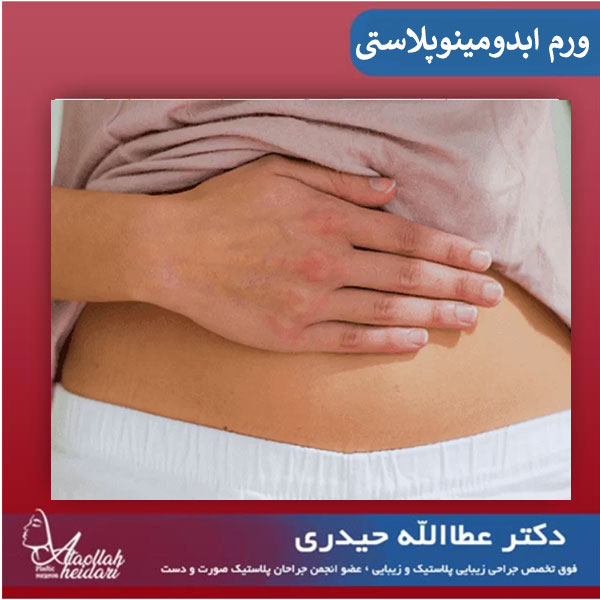 ورم بعد از ابدومینوپلاستی ، مشکلی شایع با راه حلی ساده !