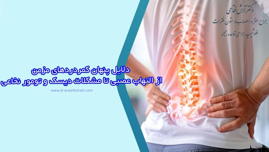 دلایل پنهان کمردردهای مزمن